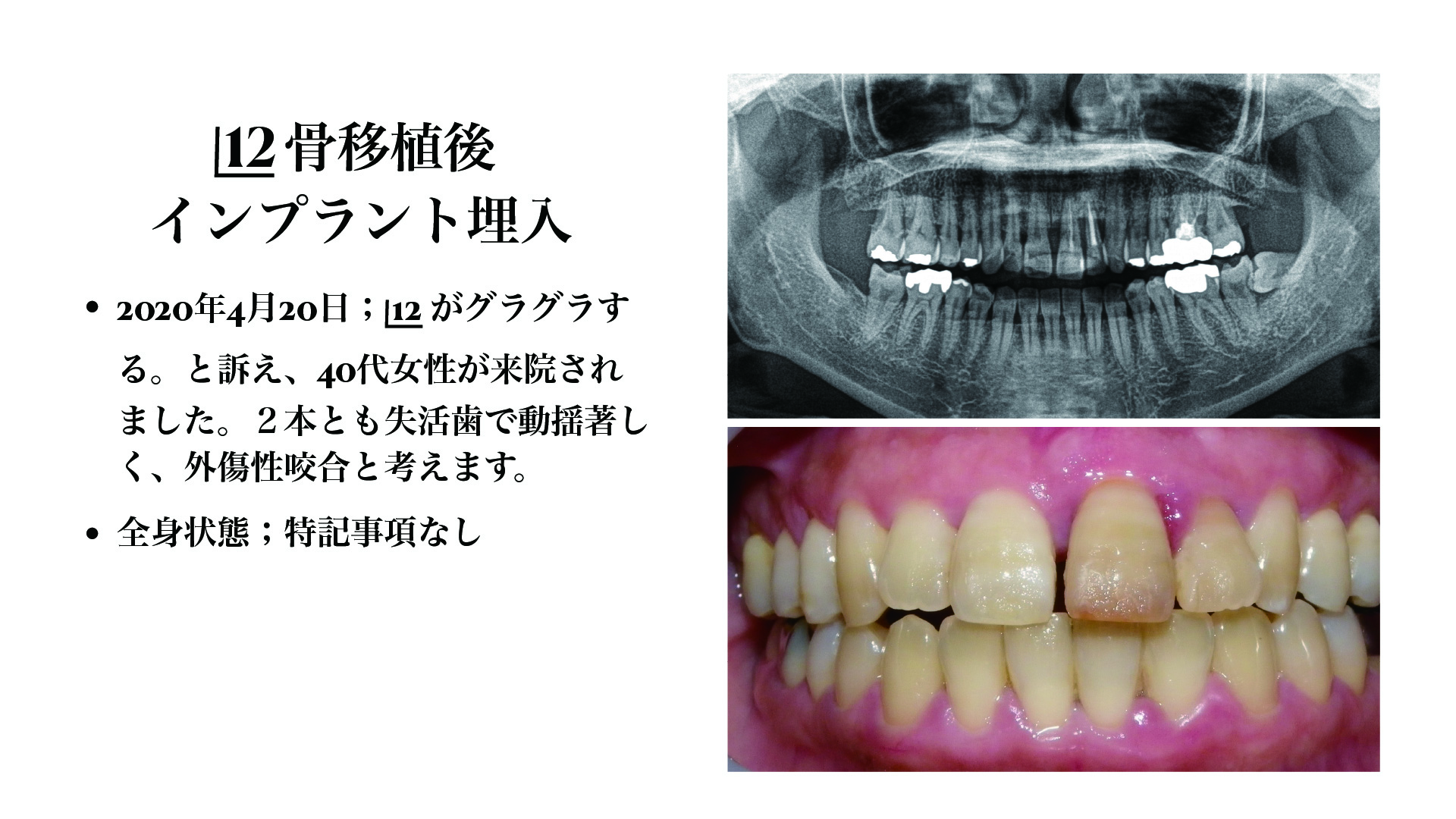 症例 43
